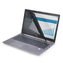 ST2_AN_ANB_1103139_14LMPRIVACYSCRN_b0108776-520e-47eb-b6fd-ef1a4a9b6f31_BIG