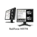 EZO_MO_603797_MX194_Particolari_BIG