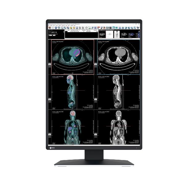 RADIFORCE MEDIC COLORE REFERTAZIONE