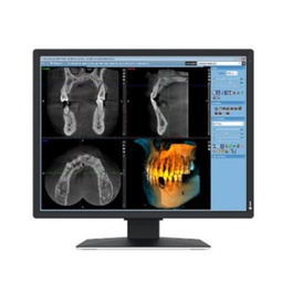 [MX217-SB] RADIFORCE MED CLINICAL REVIEW COLOR